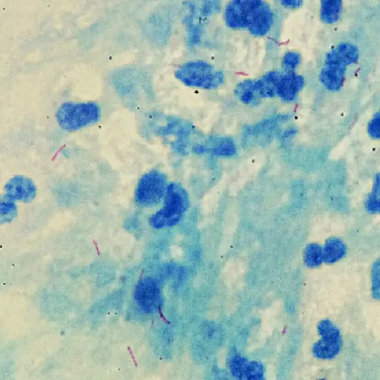 Culture AFB (mycobacterial)